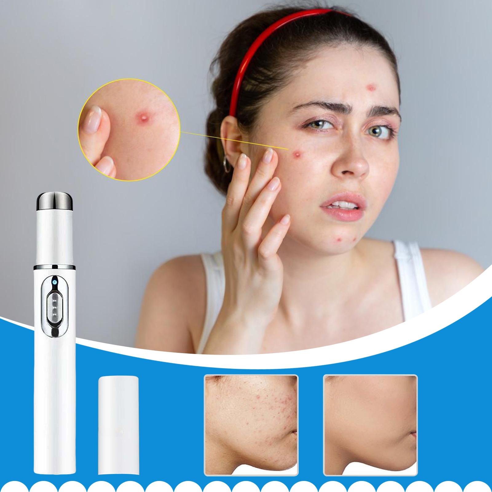 Mole Remover Pen Portable Skin - Women Accessories Combo review and price